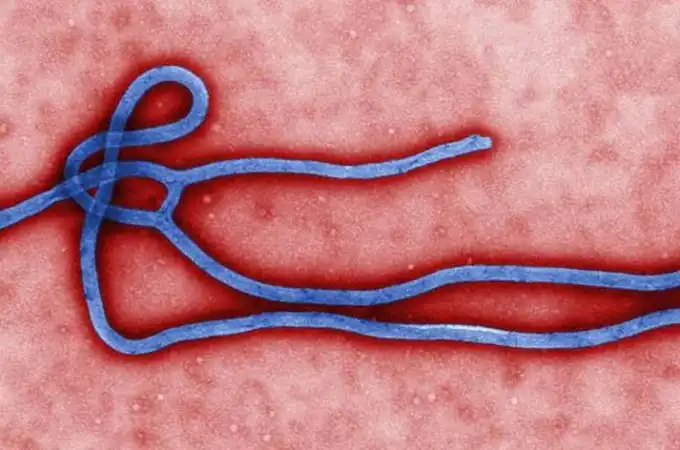 Alerta por un posible caso de ébola en el Hospital Donostia de San Sebastián