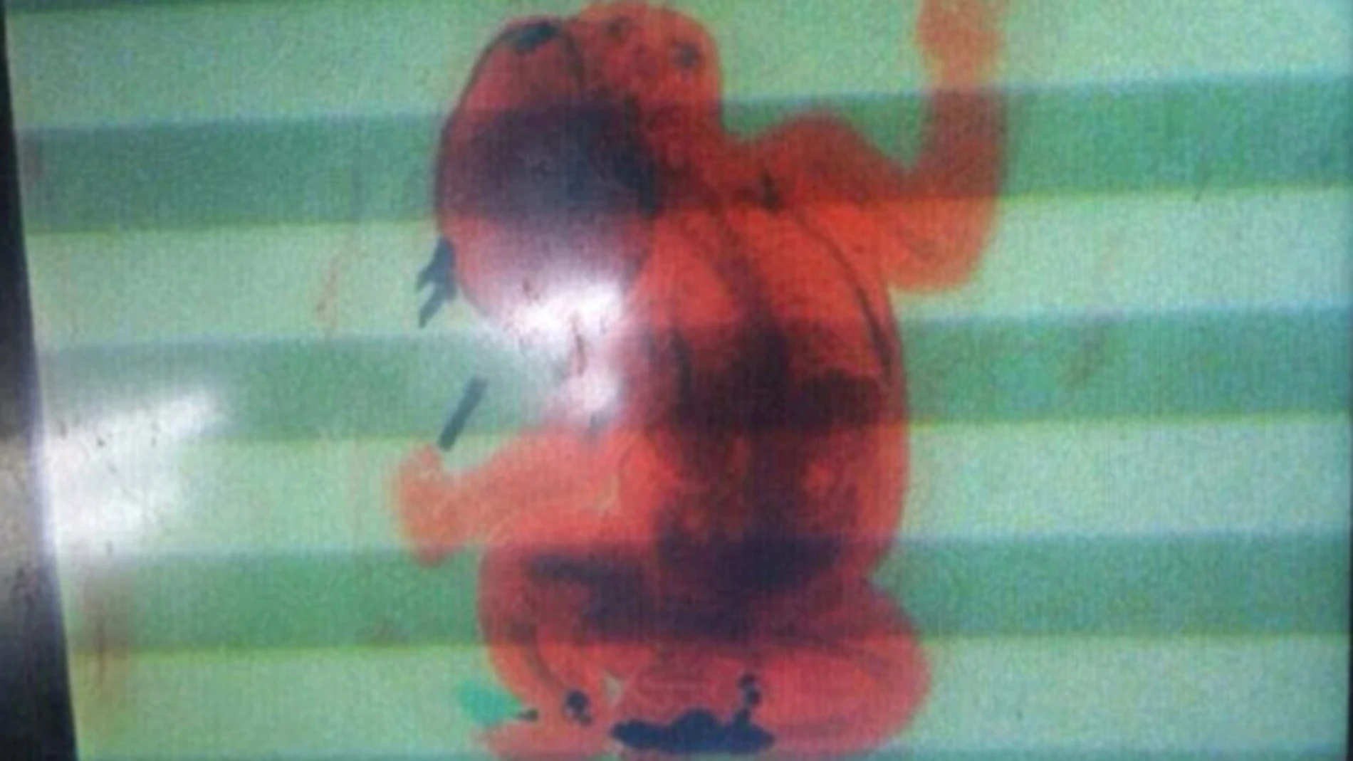 Imagen del monitor del escáner en el que de aprecia el cuerpo del bebé