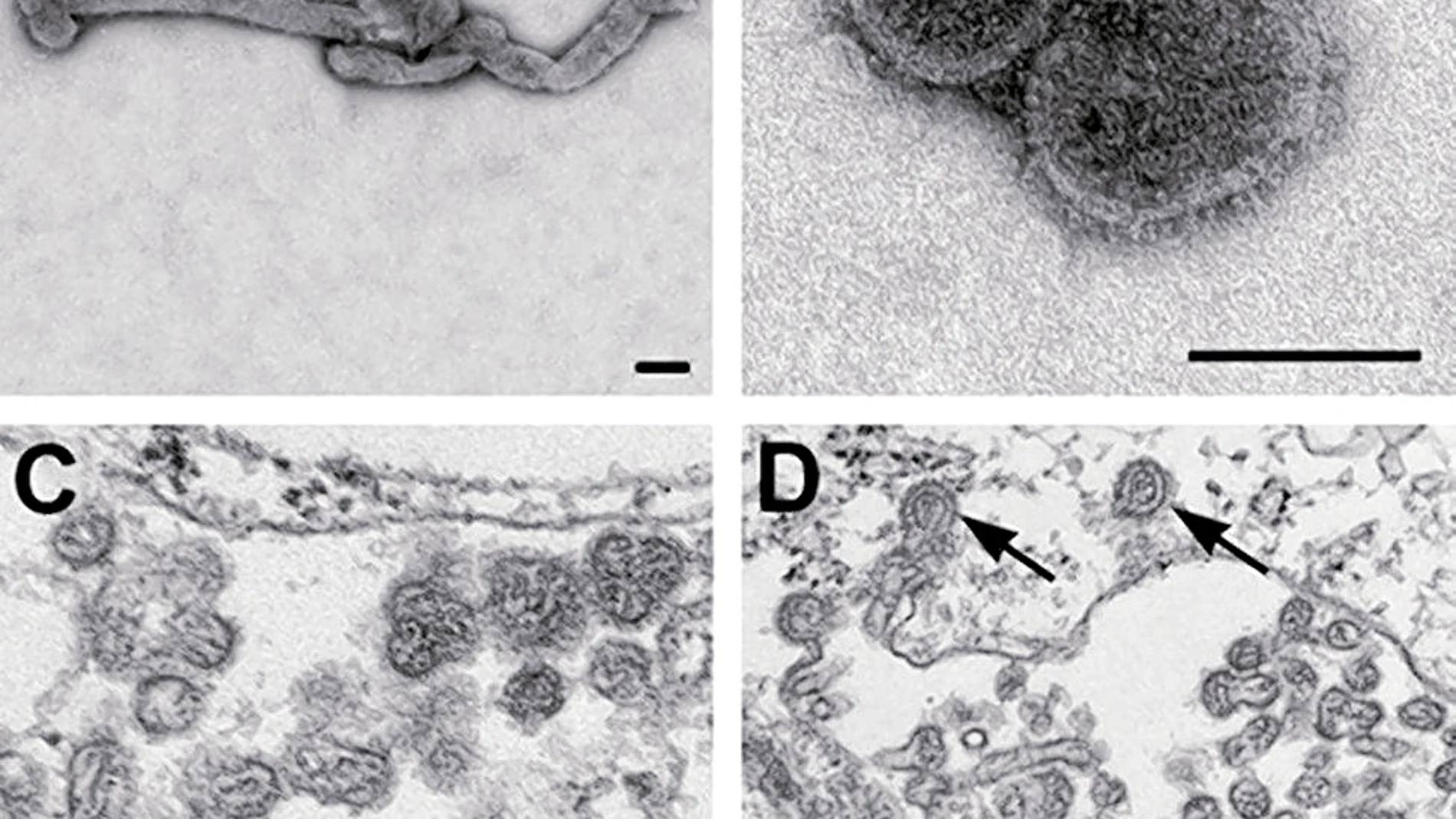 El virus mortal de la garrapata