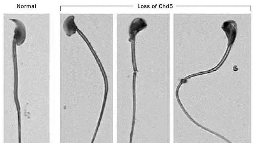 Existen mutaciones que cambian la forma del espermatozoide y alteran su movimiento, afectando a la fecundación sin afectar al número. No se ha observado ninguna tendencia en esta dirección.