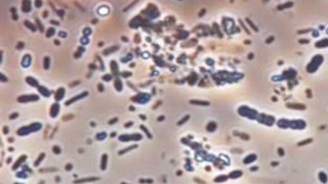 Fotografía de muestra de microbiota de heces humanas.