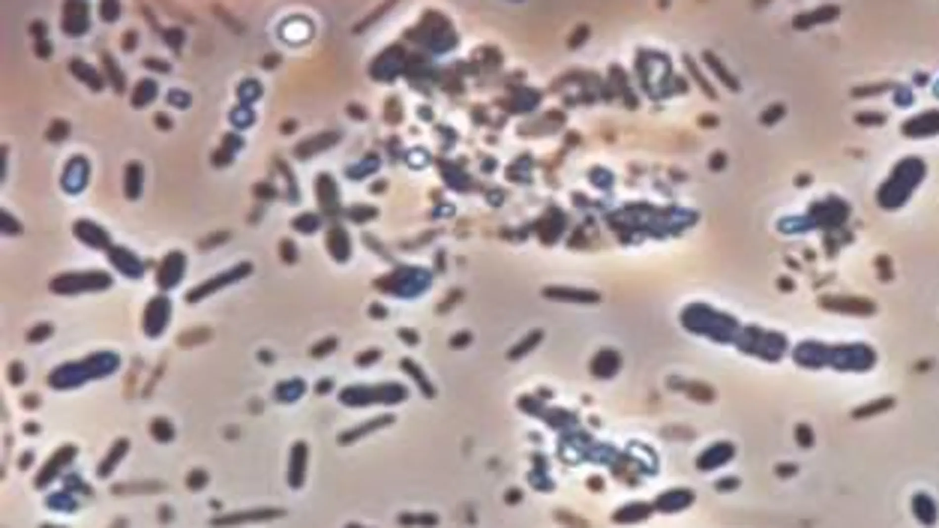 Fotografía de muestra de microbiota de heces humanas.