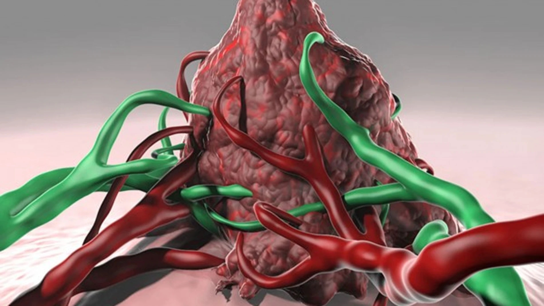 Representación artística de un tumor rodeado por vasos sanguíneos i linfáticos