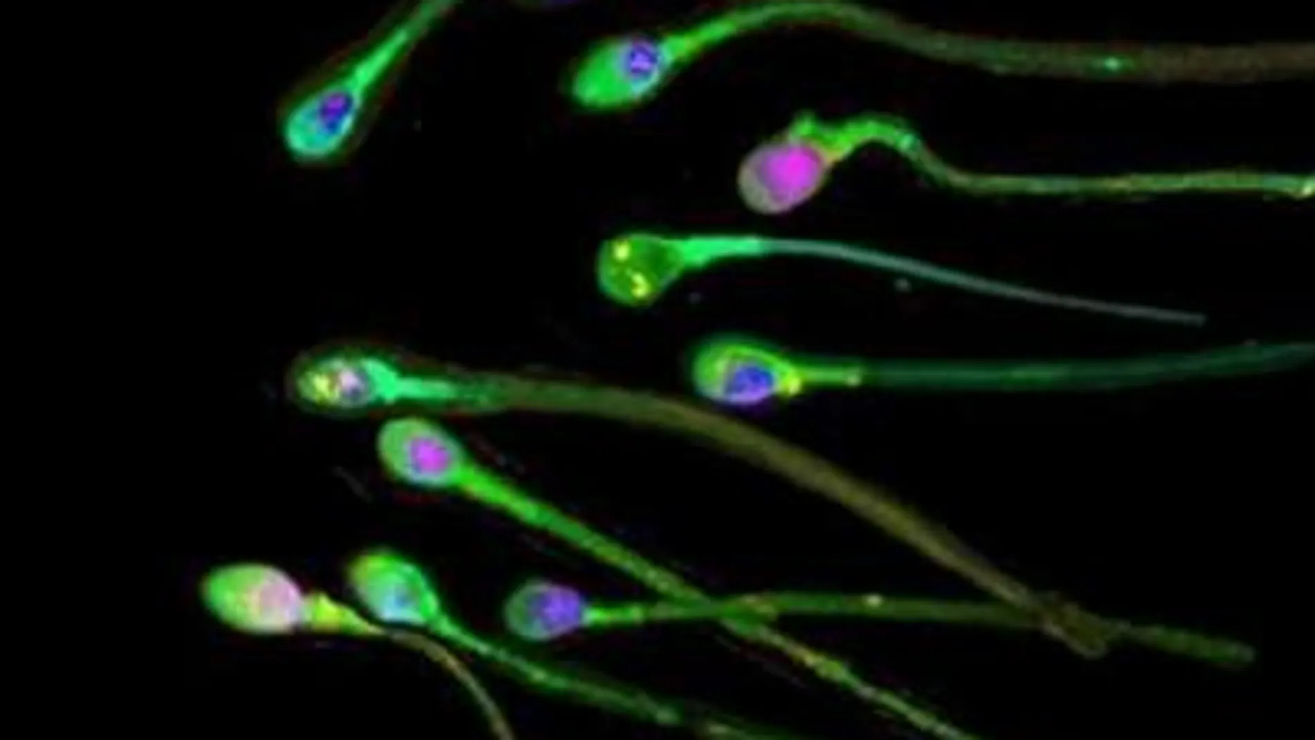 Cada vez más estudios científicos apuntan que la calidad seminal humana y la fecundidad masculina han disminuido durante las últimas décadas
