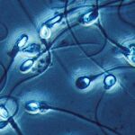 Imagen microscópica de un grupo de espermatozoides