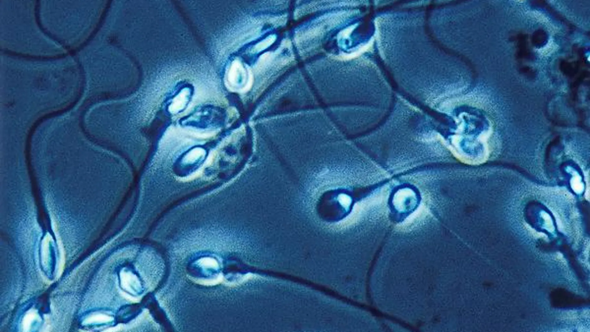 Imagen microscópica de un grupo de espermatozoides