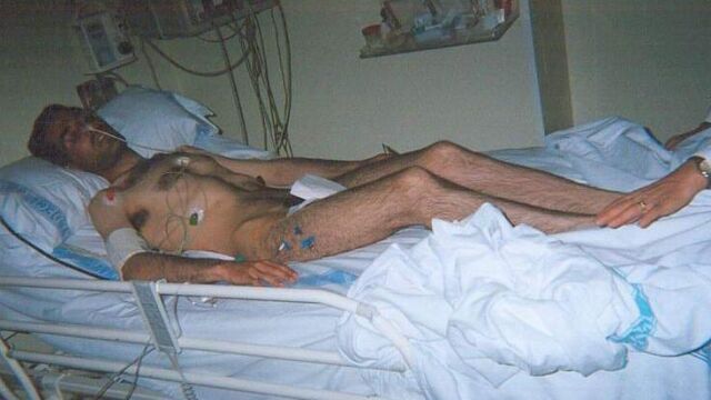 Imagen de David Villafañe, hospitalizado tras pasar más de 40 días sin alimentarse durante una de las dos huelgas de hambre anteriores