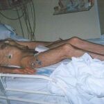 Imagen de David Villafañe, hospitalizado tras pasar más de 40 días sin alimentarse durante una de las dos huelgas de hambre anteriores