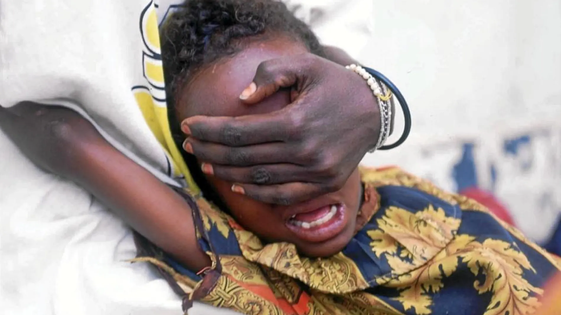 La mutilación genital femenina es una práctica ancestral que afecta especialmente a las niñas de África Subsahariana