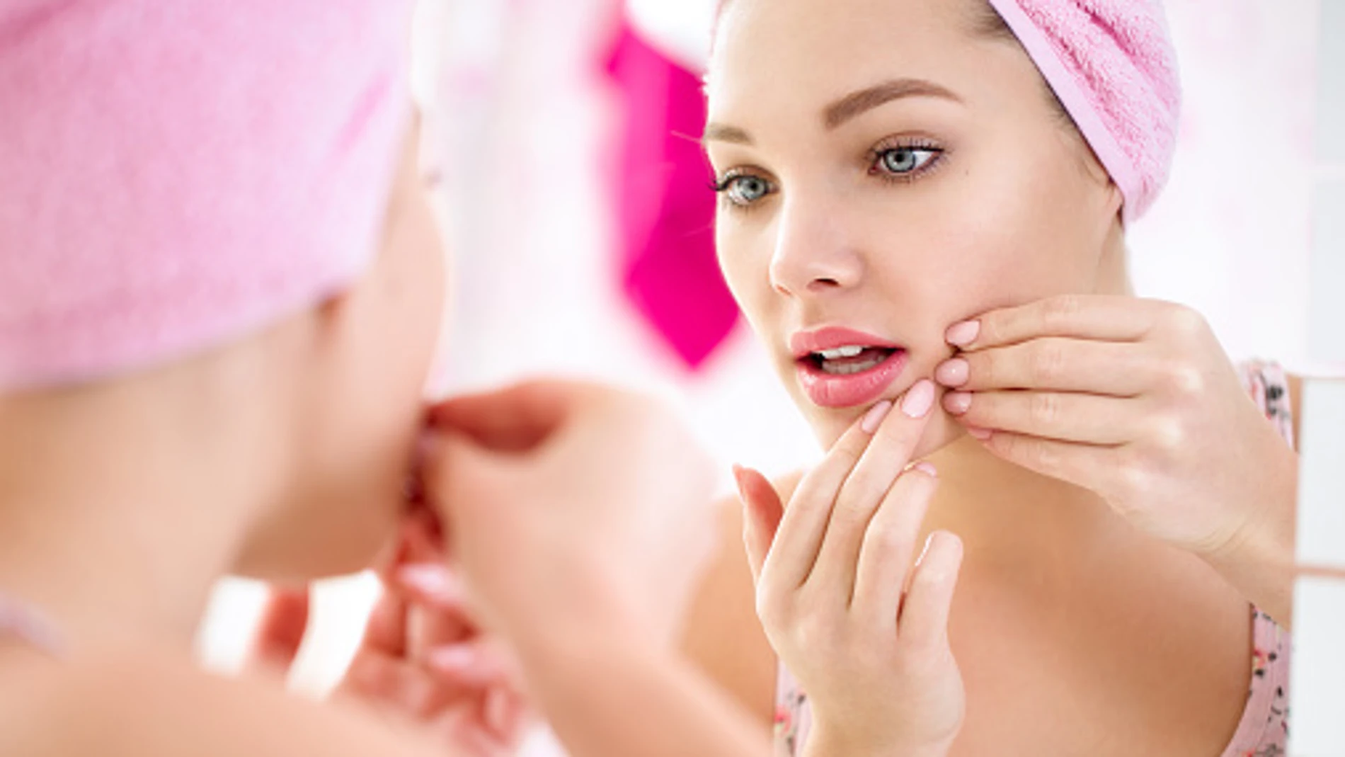 4 tratamientos para disimular las marcas del acné