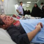 una mujer herida en un atentado en Faluya