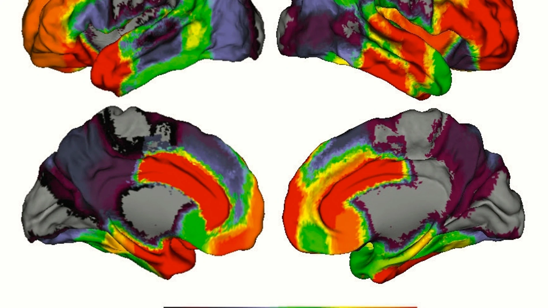 Fuerza de las conexiones entre áreas cerebrales de la superficie cortical. Los colores cálidos indican gran fuerza y los fríos lo contrario
