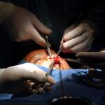Los afectados requieren cirugía desde los primeros meses de vida hasta la adolescencia
