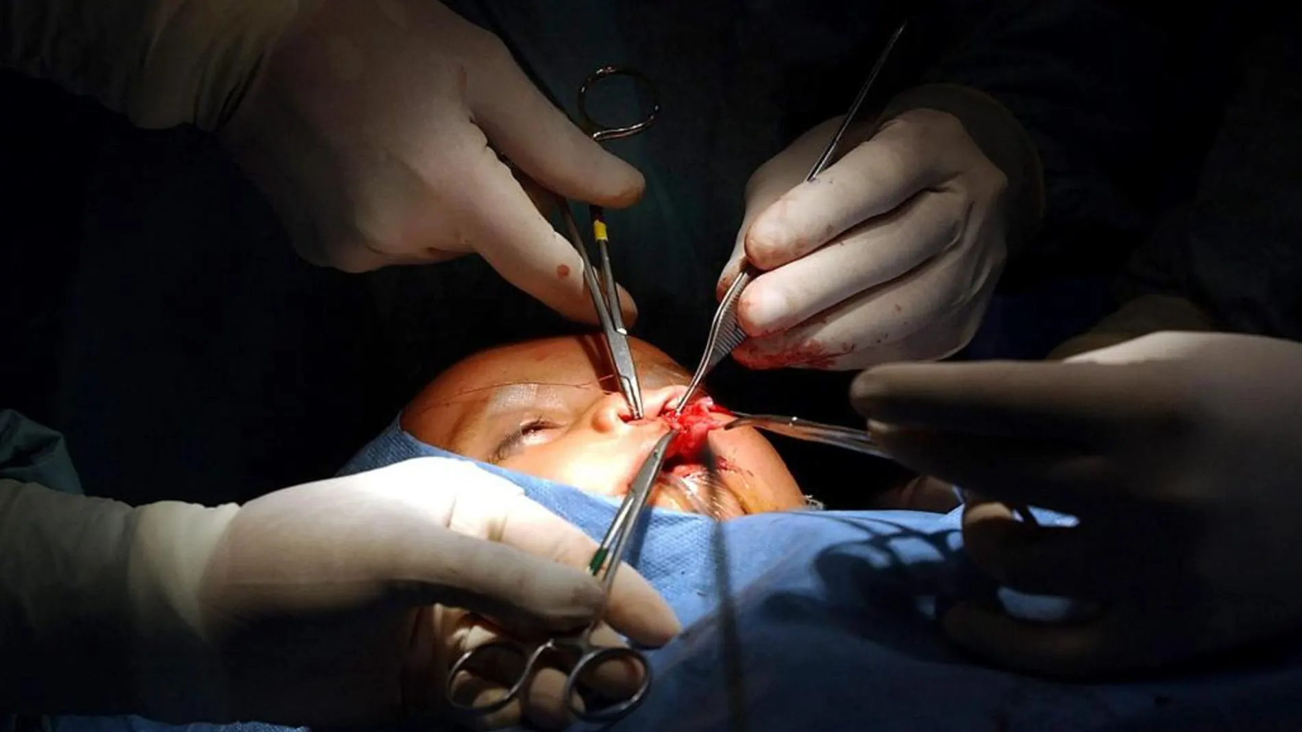 Los afectados requieren cirugía desde los primeros meses de vida hasta la adolescencia