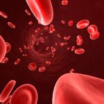 La anemia es un trastorno que consiste en una disminución en el número de glóbulos rojos y/o hemoglobina en sangre | Ilustración de archivo
