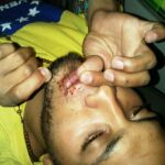 Estudiante venezolano se cose la boca tras 27 días en huelga de hambre en Caracas