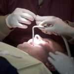 Las periodontitis más tempranas son las más peligrosas