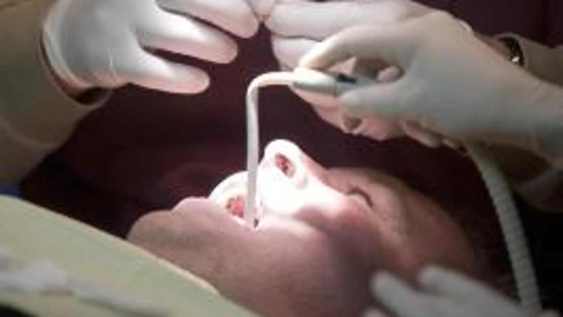 Las periodontitis más tempranas son las más peligrosas