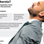 Hernia discal, la cruz de la espalda