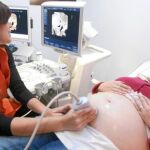 Las cesáreas en los centros privados casi duplican a las de los públicos