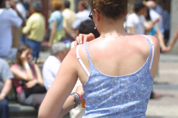 Protección solar, lo mejor para evitar la aparición de melanomas