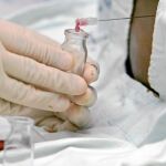 El proceso de extracción de células madre es sencillo