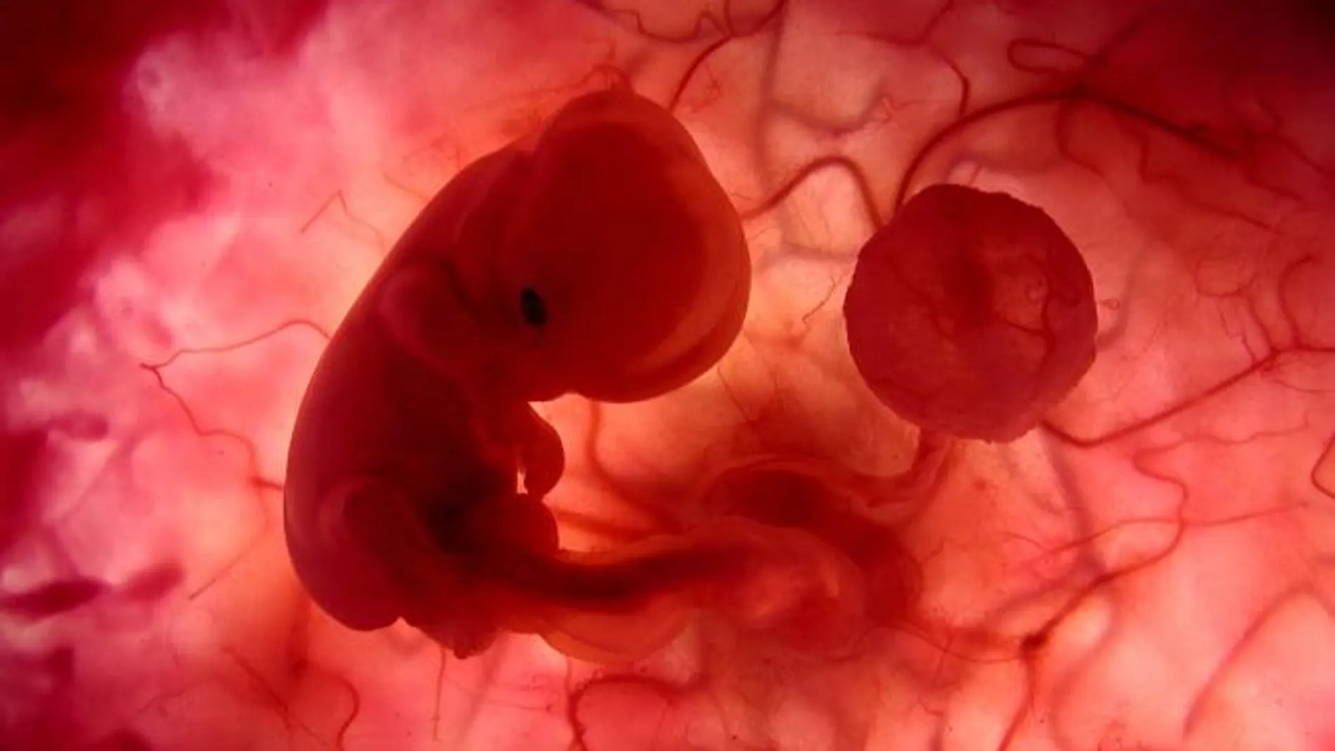 El ser humano es el único mamífero que no se come la placenta
