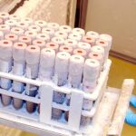 Un banco de ojos refuerza la investigación en beneficio de los castellanos y leoneses