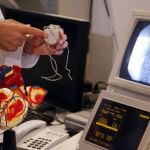 La Sociedad Española de Cardiología ha promovido su estudio con datos de 75 hospitales