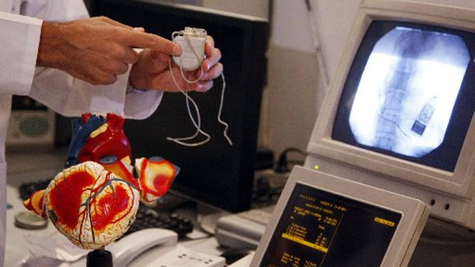 La Sociedad Española de Cardiología ha promovido su estudio con datos de 75 hospitales