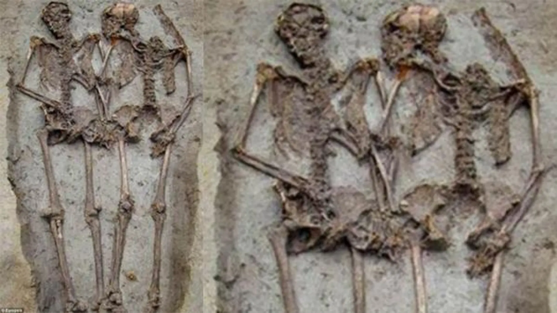 Dos esqueletos cogidos de la mano... hasta que la ciencia les separe