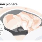 Un intervención pionera