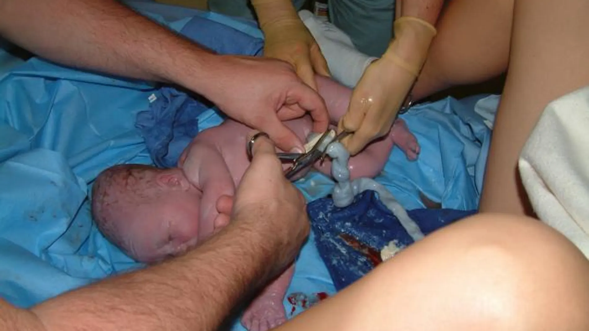 España ha sido pionera a nivel mundial en la creación y desarrollo de bancos públicos de sangre de cordón umbilical