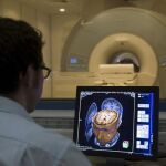 las fluctuaciones del flujo sanguíneo se podrían generar de forma anticipada en las áreas del cerebro