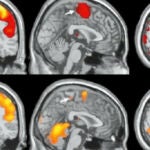 El orgasmo en el cerebro femenino