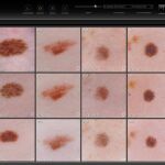 El nuevo equipo es capaz de tomar imágenes de todo el cuerpo y replicar la superficie de la piel en 3D en menos de un segundo