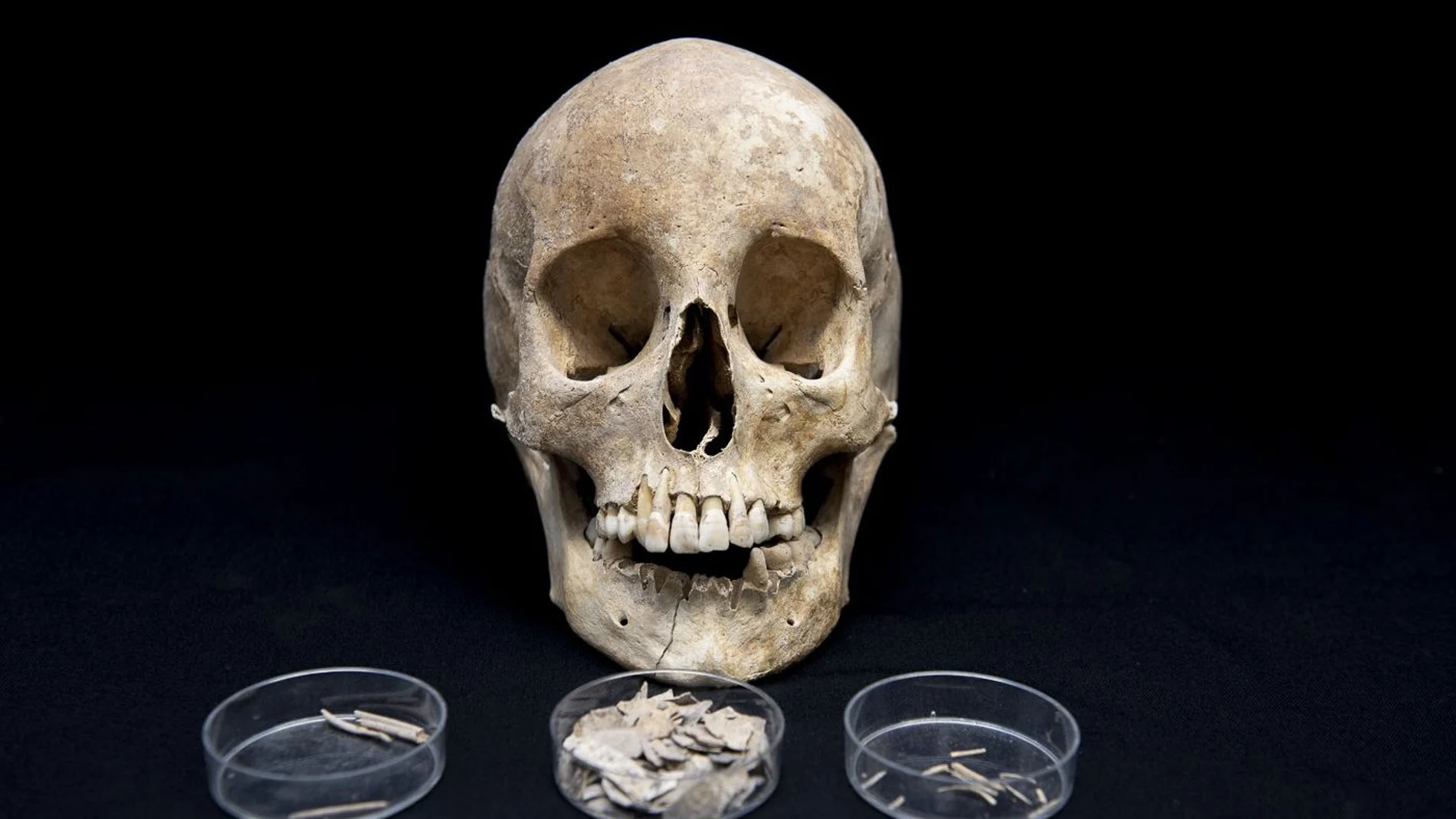 El cráneo de la joven Isabel de Martorell frente a los huesecillos del feto de cinco meses que portaba cuando falleció
