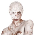 La psoriasis es una enfermedad inflamatoria de la piel crónica