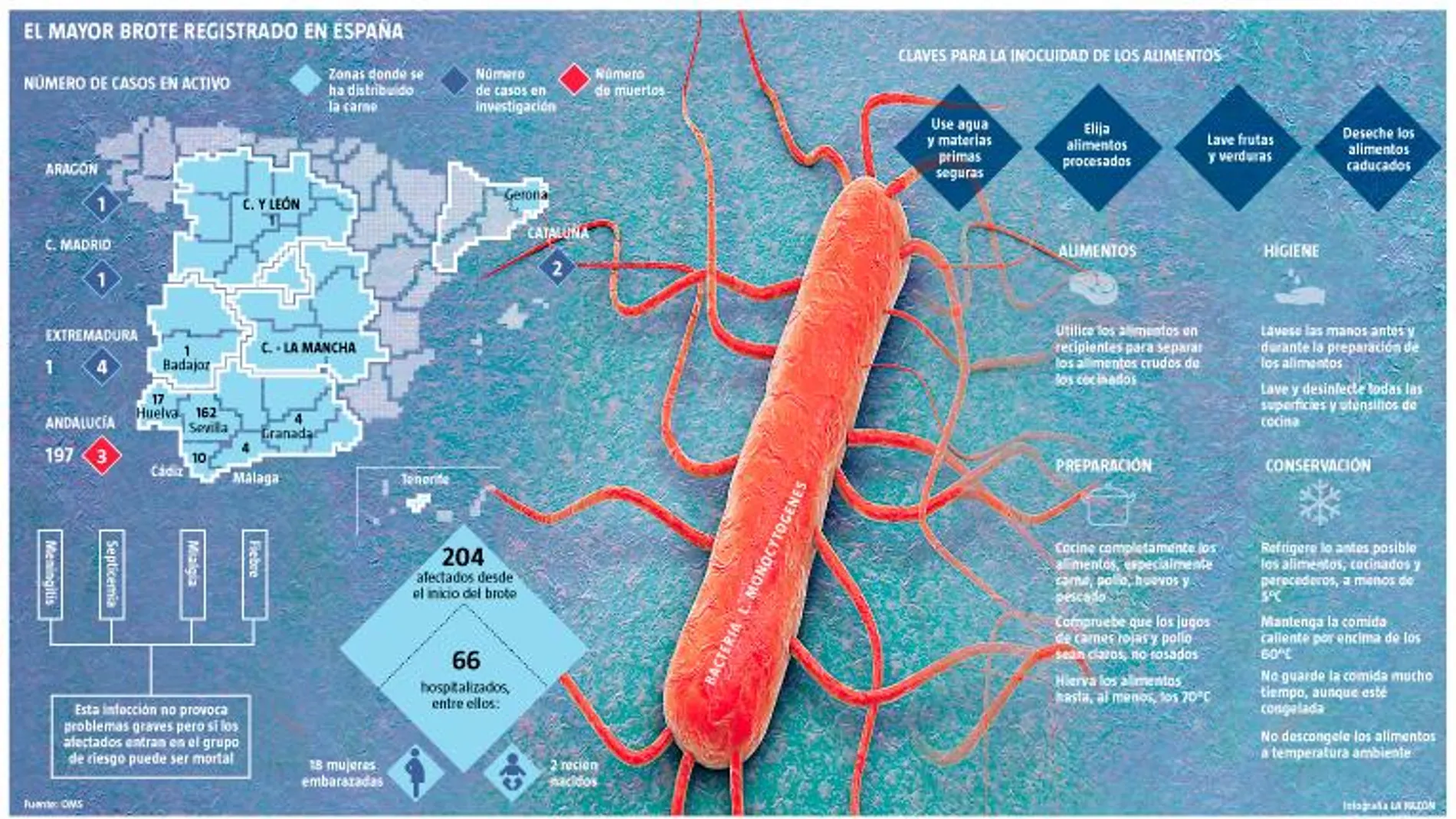 Listeriosis. España concentra la mayor parte de la bacteria en la UE