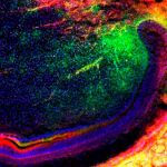La imagen muestra a un grupo de células madre mesenquimales (verde) migrando en un diente para regenerar a un más los tejidos