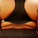 La obesidad es uno de los principales factores de riesgo que influyen en las enfermedades cardiovasculares en todo el mundo / Foto: Reuters