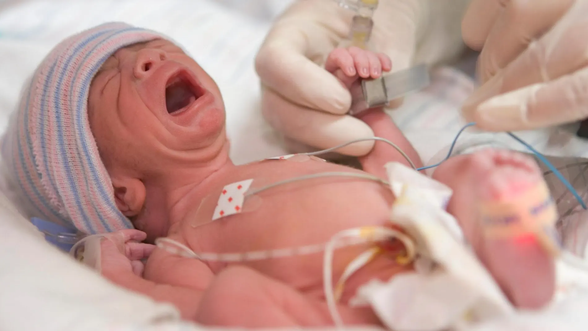 Los riesgos de un parto vaginal tras haber dado a luz por cesárea