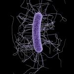 La bacteria Clostridium botulinum puede causar naúseas, vómitos, diarrea y hasta la parálisis del sistema nervioso