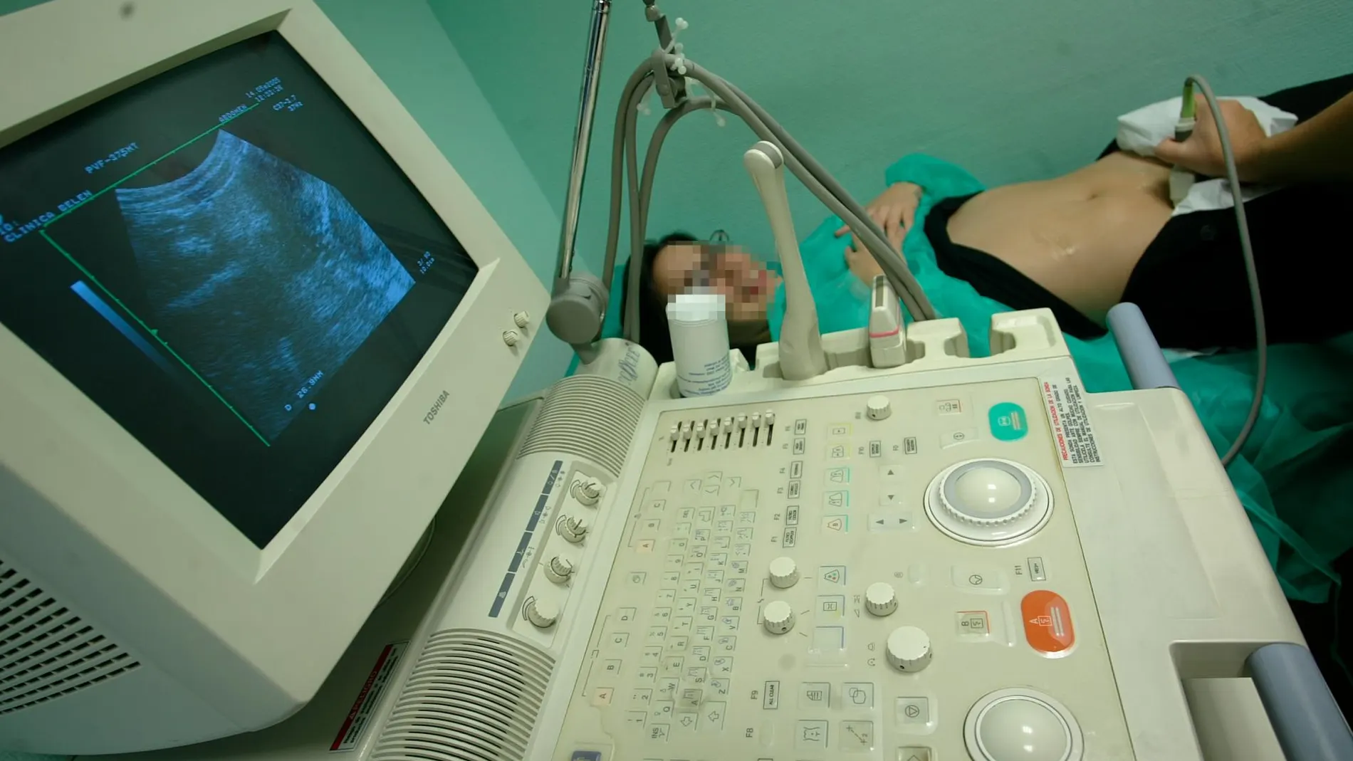 Después de la primera ecografía en la que se observa el latido del bebé, se procederá a las revisiones ginecológicas habituales de la paciente/Foto: Añvaro garcía