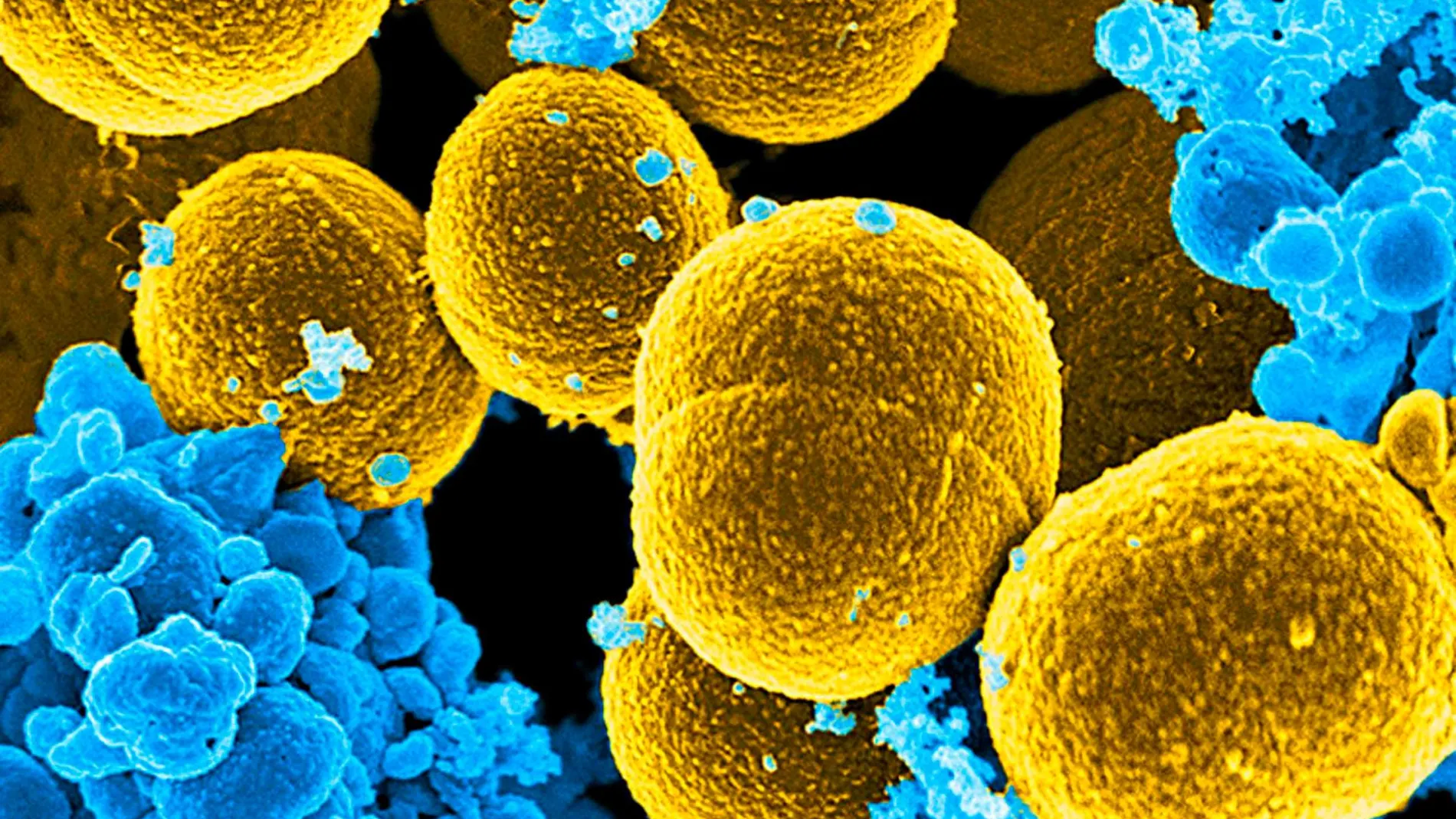 Una imagen del Staphylococcus aureus