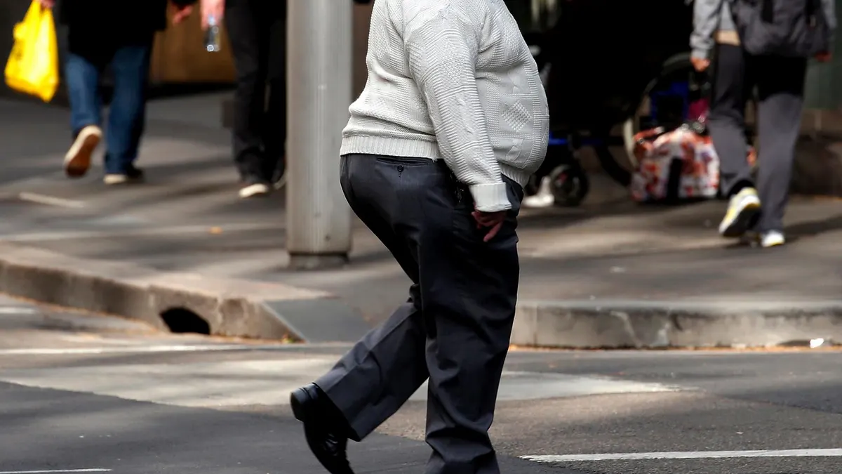 Solo el 42% de las personas cree que la obesidad es una enfermedad crónica 