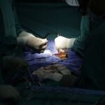 Cirujanos cardiovasculares realizan una operación