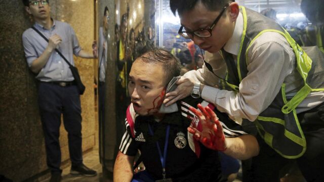 Chiu recibiendo asistencia sanitaria después de perder la oreja