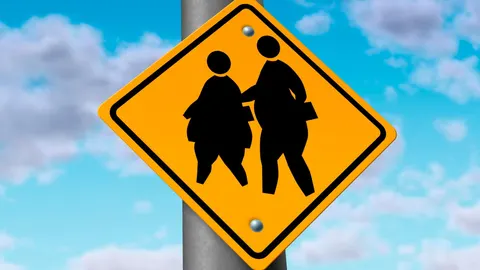 El sobrepeso es causa de patologías como el «pie plano» en los niños