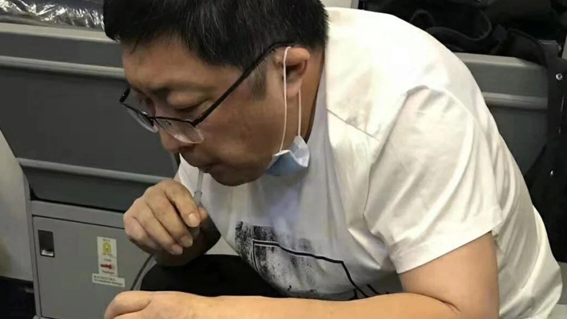 El doctor Zhang estuvo 37 minutos extrayendo la orina del paciente